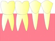 Les dents d'une mme arcade sont cte  cte et restent 
