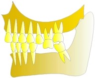 La dent continue de descendre, sa voisine, la deuxime prmolaire se disloque galement et perd ses contacts.
