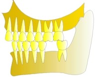 Une premire molaire infrieure a t extraite, la dent qui se trouve en face n'est pratiquement plus en fonction et commence lgrement  se disloquer.